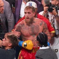 Jake Paul has second jaw surgery two months after bout