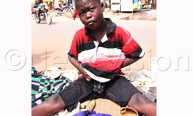 Helpless street kid passes stool through stomach Helpless street kid passes stool through stomach