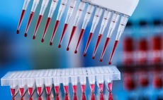 China biotech: End of the boom