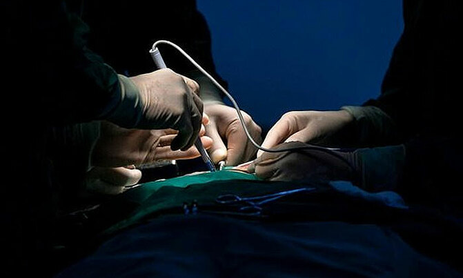 Doctors find 122 nails in Ethiopian's stomach Doctors find 122 nails in Ethiopian's stomach
