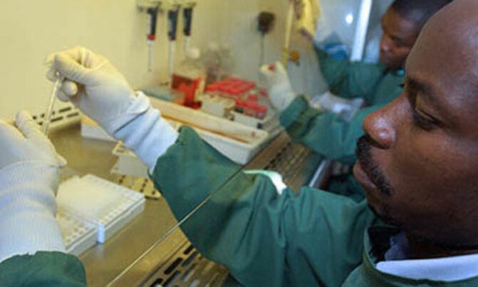 HIV vaccine expected in 10 years, medical experts say HIV vaccine expected in 10 years, medical experts say