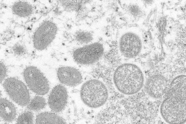 US buys millions of vaccine doses for new virus