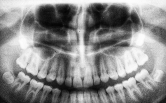 MBK buys Korea dental scanning player Medit, Unison exits