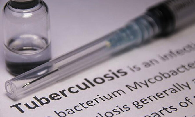 Resistance risk for new TB drugs - experts Resistance risk for new TB drugs - experts