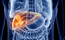 VC-backed Sequana Medical sets IPO price range