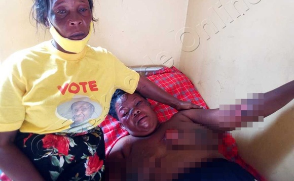 Mukwano gwa Namyalo ng'amujjanjaba mu ddwaaliro. Namyalo aliko ebiwundu mu kifuba ne ku mukono era azimbye ne mu maaso. Mukwano gwa Namyalo ng'amujjanjaba mu ddwaaliro. Namyalo aliko ebiwundu mu kifuba ne ku mukono era azimbye ne mu maaso.