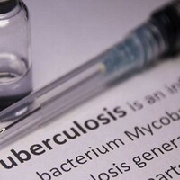 TB incidence in India drops by 21% from 237 per lakh population in 2015 to 187 per lakh population in 2024: Report