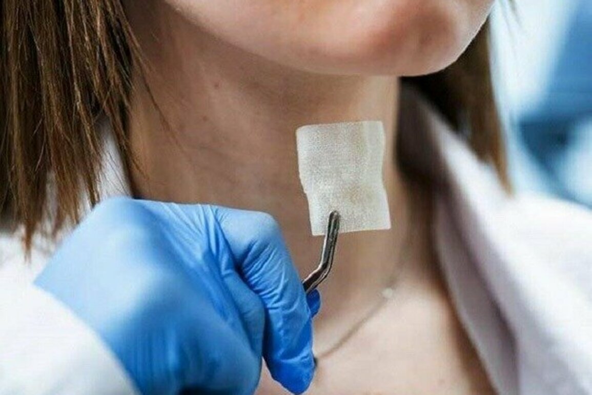 Russian scientists develop first 3D-printed laryngeal implant to accelerate cancer recovery