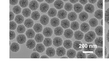 When filled with biopesticides like tea tree oil, tiny silica nanoparticles with surface spikes purpose-built to give prolonged periods of protection (pictured) could be a key puzzle piece for flystrike control.