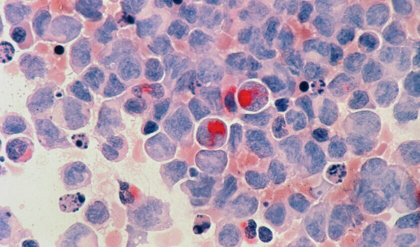 (c) National Cancer Institute 