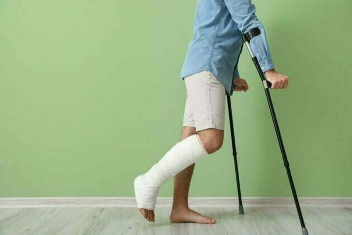 Why some people are purposefully having their legs broken by cosmetic surgeons