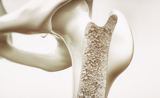 Apposite acquires OrthoD from The Riverside Company