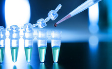 Caixa Capital Risc leads €2.4m round for GlyCardial