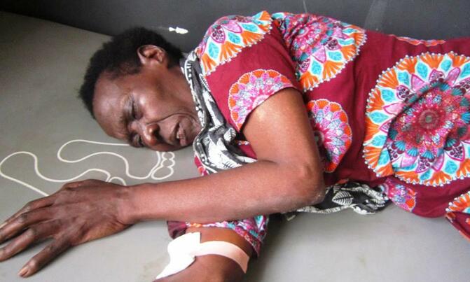 2 dead, 45 injured in Mbale bus accident 2 dead, 45 injured in Mbale bus accident