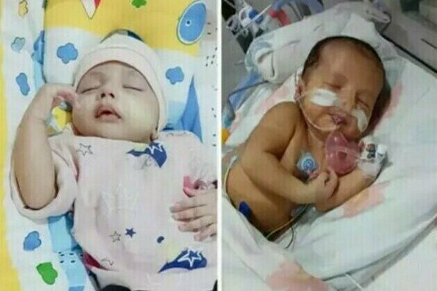 Fundraising Drive for Baby of Samrah Naqvi Battling Congenital Cyanotic Heart Disease Initiated on ImpactGuru.com