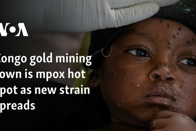 Congo gold-mining town is mpox hot spot as new strain spreads