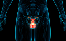 Spotlight: Prostate & Testicular Cancer
