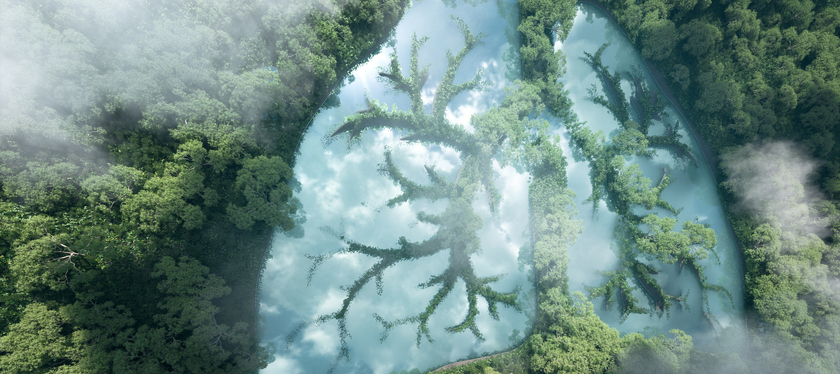 Notes from the Amazon: Addressing portfolio deforestation risk 