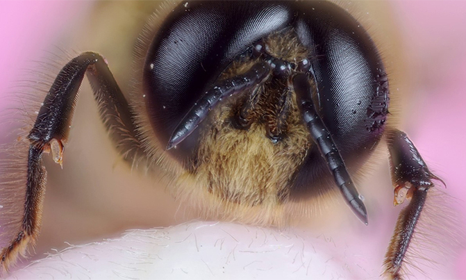 Eye'll bee damned: woman finds insects in eye Eye'll bee damned: woman finds insects in eye