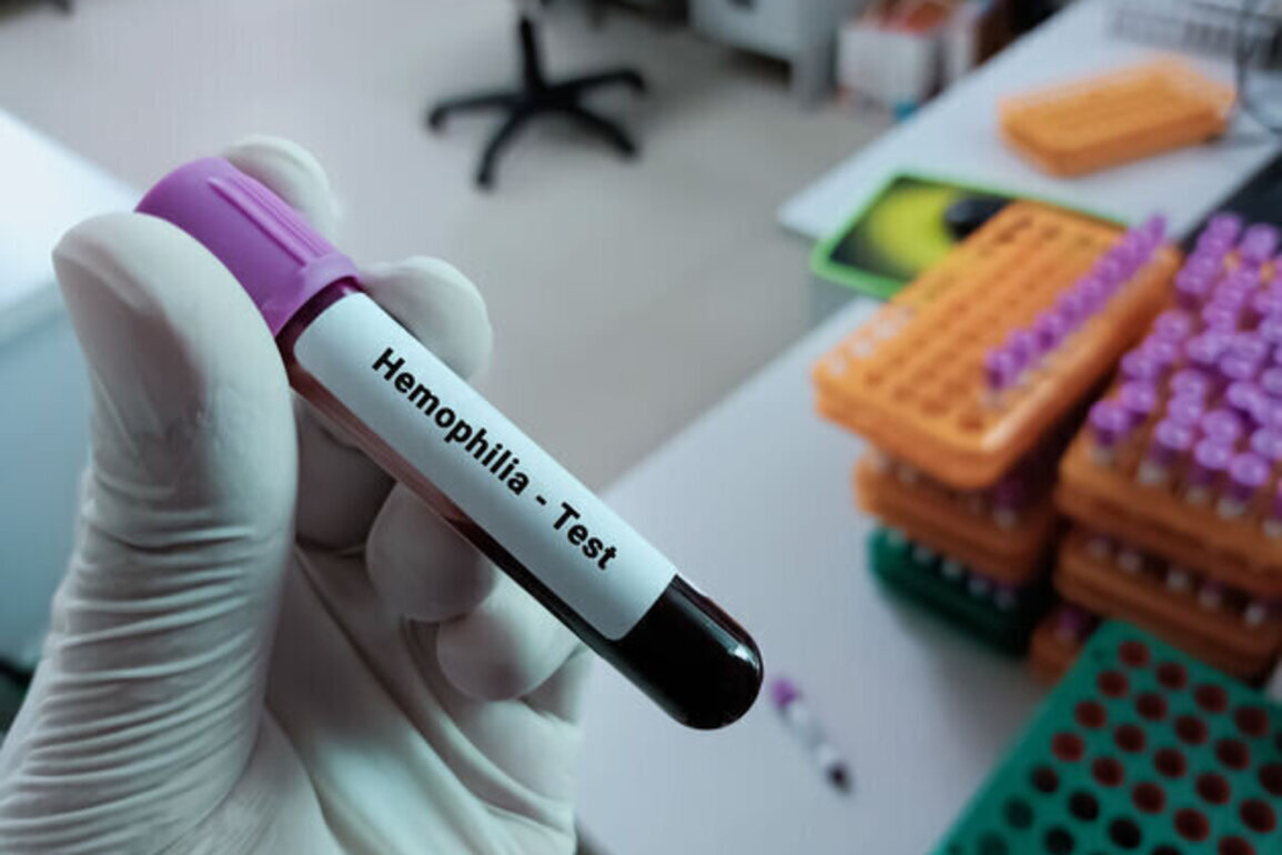 IN hemophiliac patients have innovative treatment option 