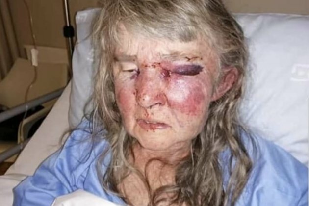 Two behind bars after woman, 74, severely beaten during burglary