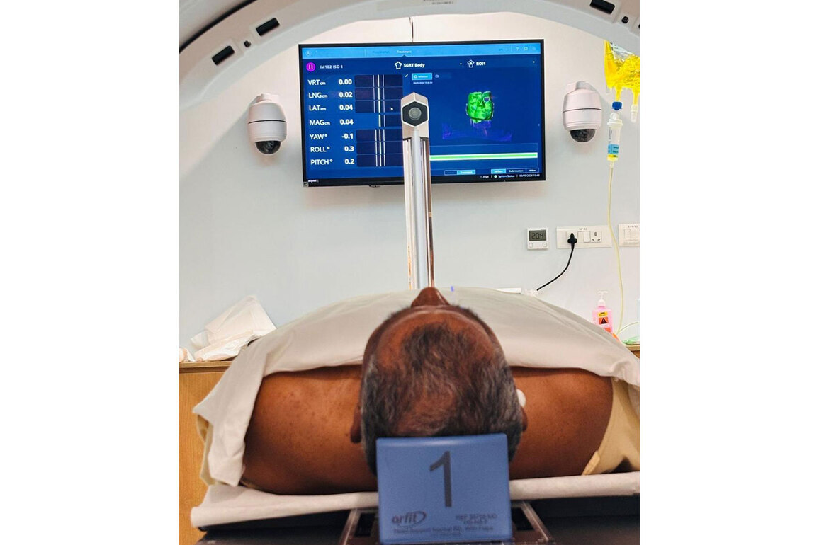 India achieves AI breakthrough in cancer care with mask-free, simulationless radiotherapy