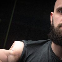Banchory Hyrox star- Cancer took half my shoulder