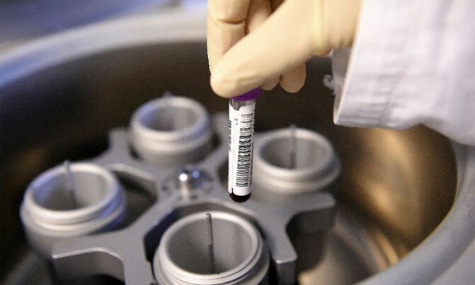 Crimean Congo fever confirmed in Masindi Crimean Congo fever confirmed in Masindi