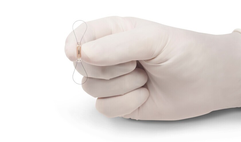 The CardioMEMS HF System © Abbott 