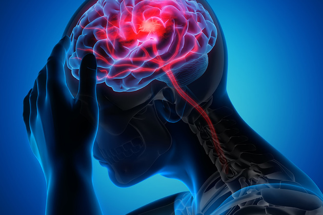 World Stroke Day: Experts raise concern over brain strokes among young adults under 45