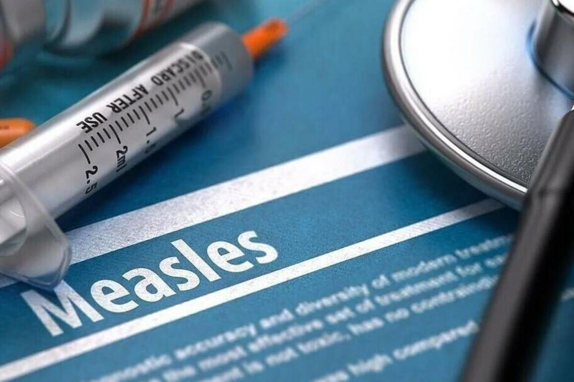 Montana measles tracker launched after five cases confirmed