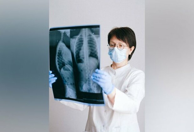 New screening tool aims to help in COPD diagnosis