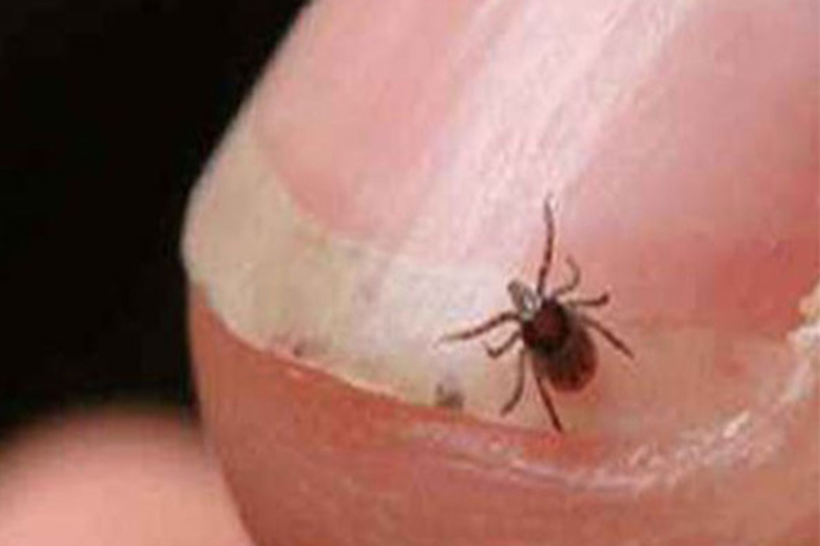 Shimla: Three test positive for scrub typhus at IGMC