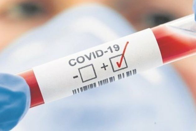 Virus spurs global free-for-all over $597 billion medical trade