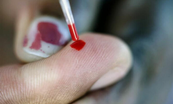 Fake HIV testing kits on the market Fake HIV testing kits on the market