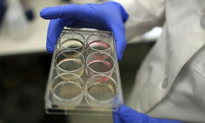 US companies sell unapproved 'stem cell treatments' US companies sell unapproved 'stem cell treatments'