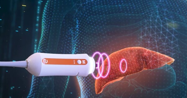 NHS scanning trucks help thousands get liver cancer checks