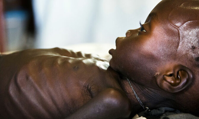 1.4 million African children at imminent risk of death as famine looms 1.4 million African children at imminent risk of death as famine looms
