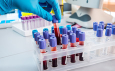 Accelerated Ventures invests £3.5m in Biosignatures