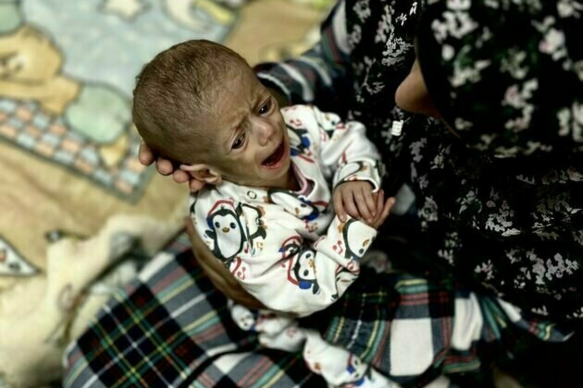 Images of Gaza's starving babies have gone round the world. This is what malnutrition does in the first 1,000 days of life