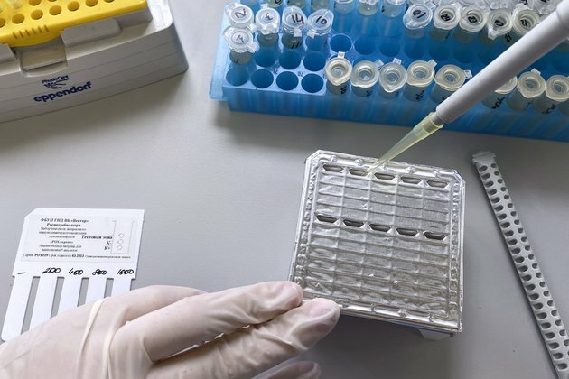 Monkeypox hasnt spread in Russia watchdog