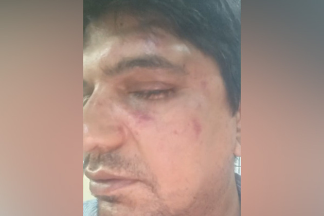 Karnataka: Professor alleges he was thrashed for objecting to littering in Bengaluru; police complaint filed