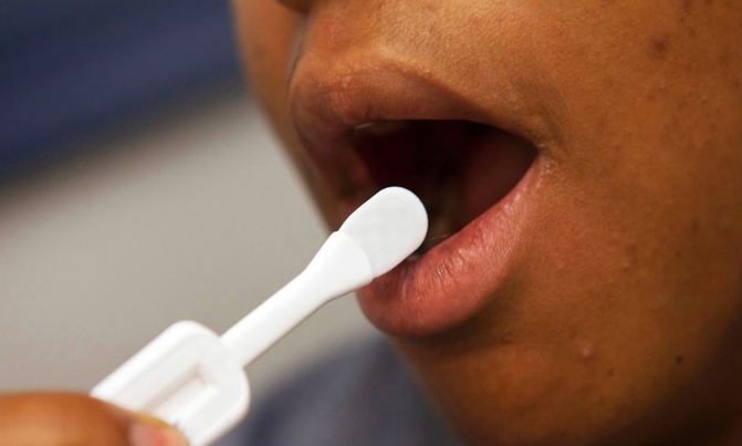 Uganda could benefit from $25m HIV self-testing fund Uganda could benefit from $25m HIV self-testing fund