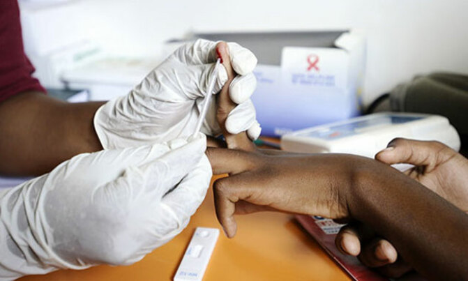 Why women are more prone to HIV infection Why women are more prone to HIV infection
