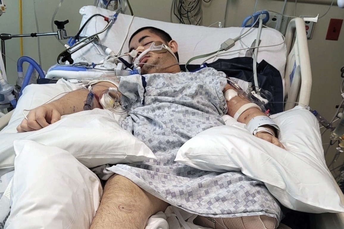 Disabled teen shot by Idaho police dies