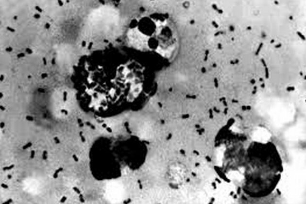Squirrel in Colorado tests positive for bubonic plague