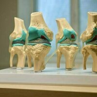 What are the key risk factors for developing knee osteoarthritis? We reviewed the evidence