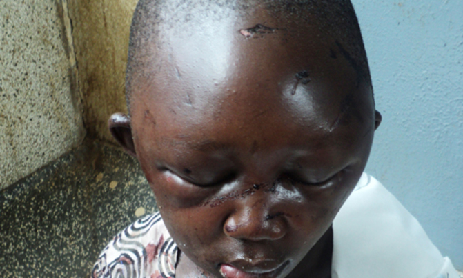 Father beats daughter to near death over sh5000 Father beats daughter to near death over sh5000