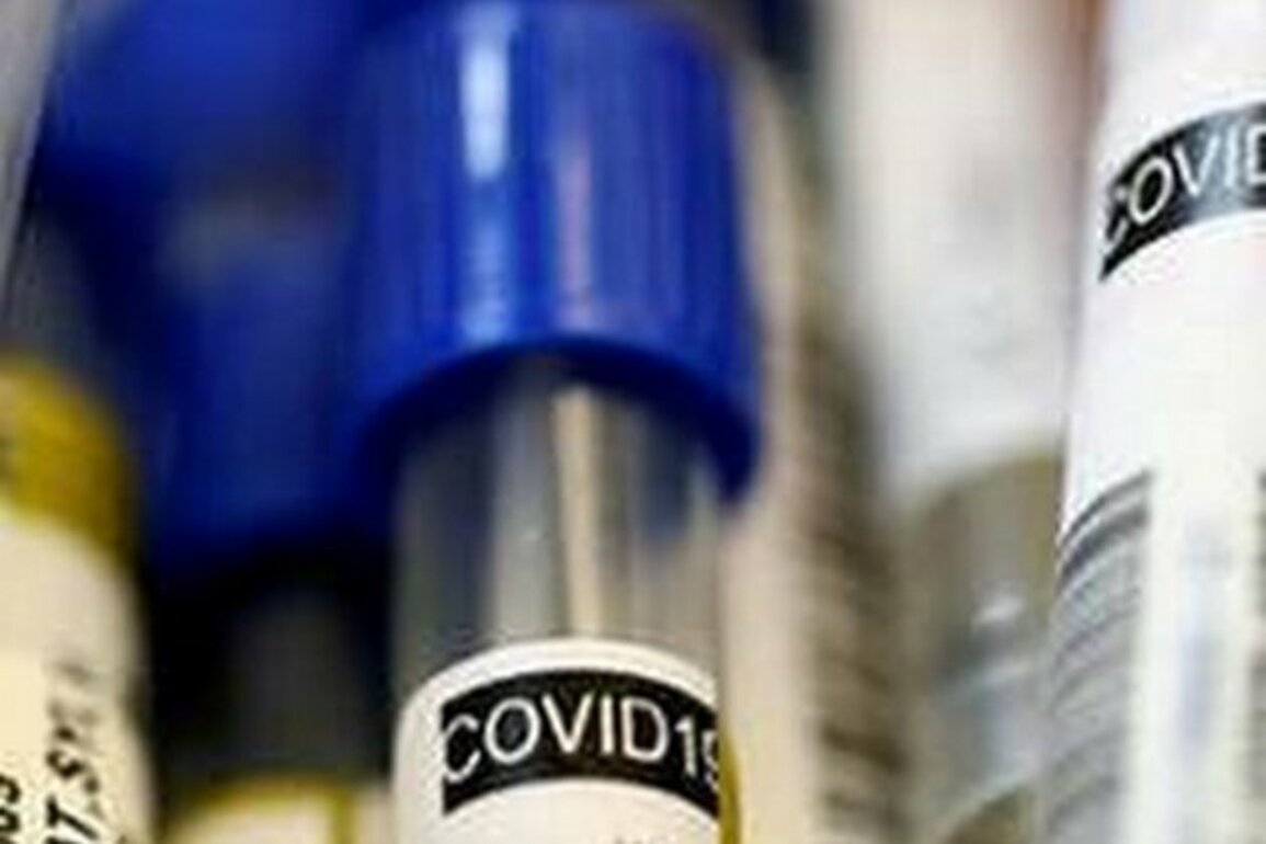 Over 39,000 new COVID19 cases confirmed in Brazil over 24-hours