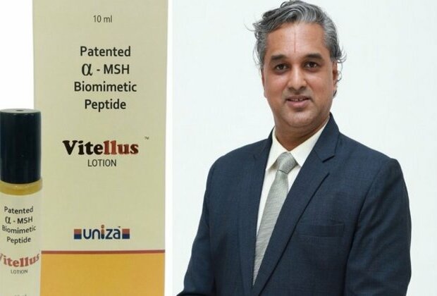 Uniza Group launches a novel solution for the management of Vitiligo